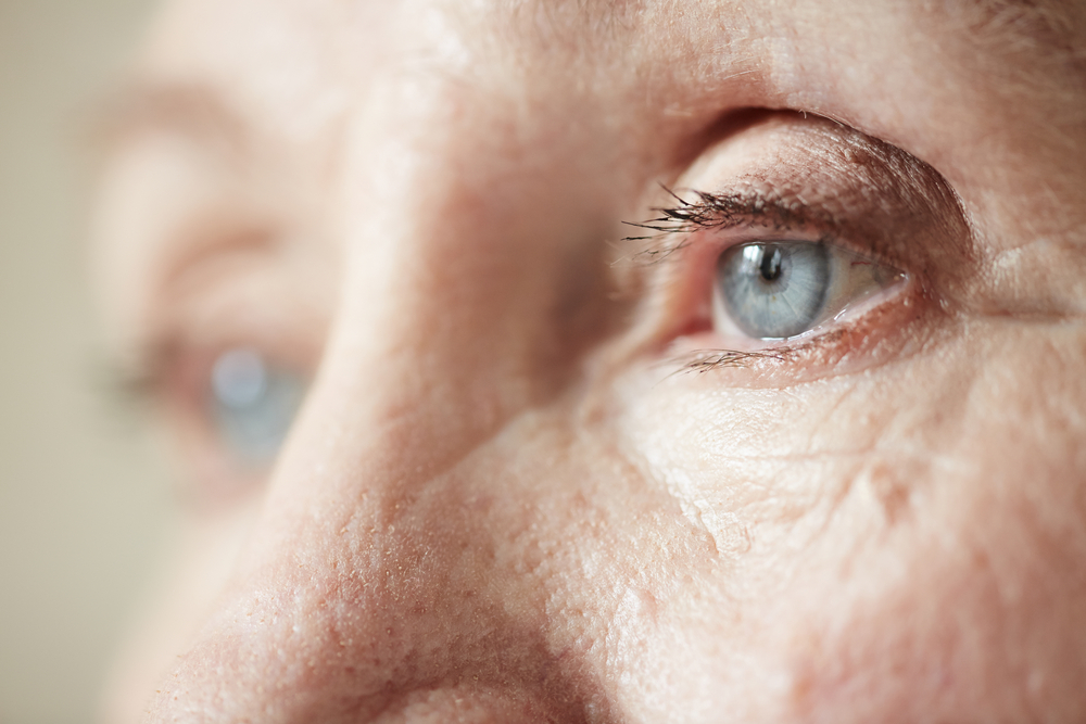 Arco senil: sintomas, causas e tratamentos